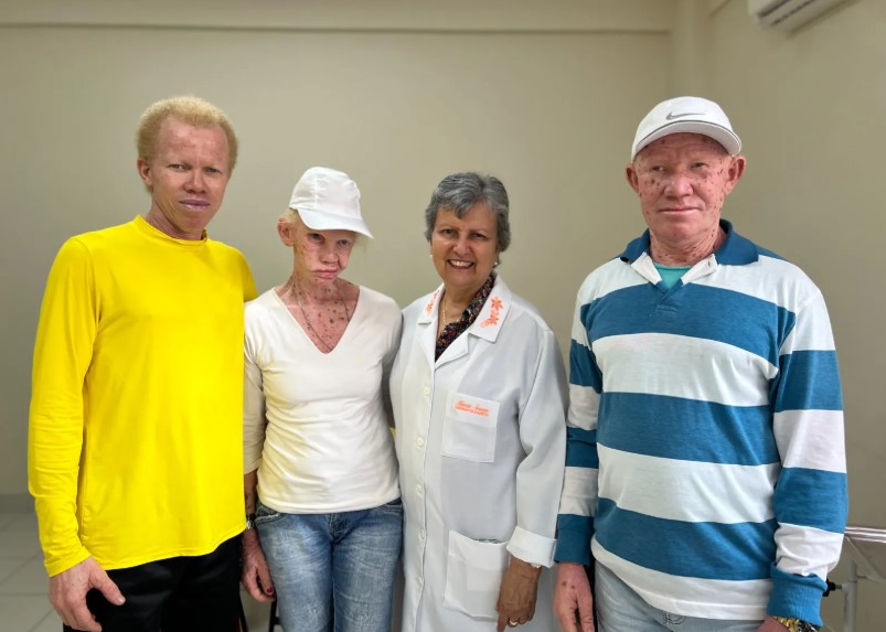Imagem de ICB celebra Dia do Albinismo com atendimento especializado e aula de forró para pacientes
