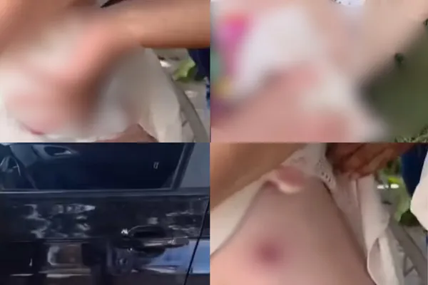 Imagem de Turistas são feridas a tiros ao passar por área próxima a protesto na Bahia